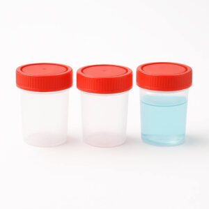 Urine Container